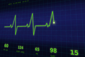 A graph of normal heartbeat on a blue monitor