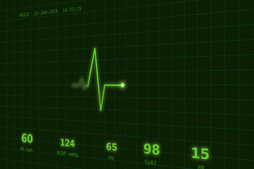 Graph of normal heartbeat on the green monitor slightly to the side