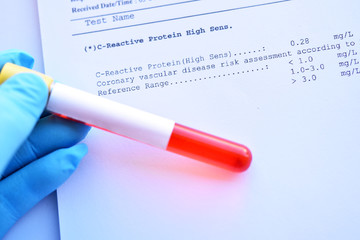 Normal result of C-reactive protein or CRP test with blood sample tube