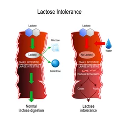 Fotobehang Lactose intolerance or lactose digestion. Small and large intestine. © designua
