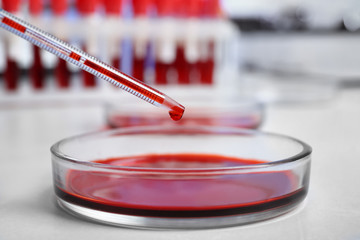 Pipetting blood into Petri dish for analysis on table in laboratory, closeup
