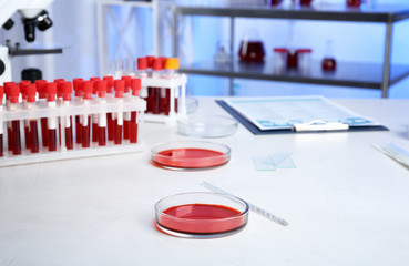 Test tubes and Petri dishes with blood samples for analysis on table in laboratory