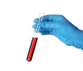 Laboratory worker holding test tube with blood sample for analysis isolated on white, closeup