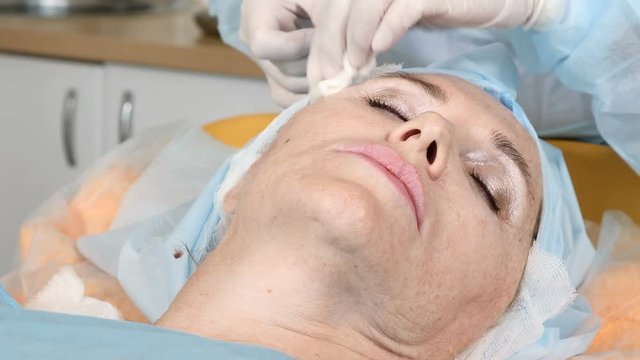 Face thread lifting procedure. Senior woman in her late 50s in beauty clinic. Closeup shot of beautician hands making facial skin lifting. Cosmetology concept. 4k