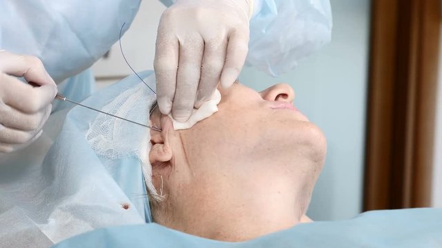 Cosmetic procedure to eliminate signs of aging. Beauty of Face, Facial contour, plastic surgery concept for Age 40-50 years. Aged patient in beauty clinic. 4k