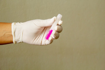 Hand of a doctor holding a bottle of Viral Transport Media (VTM) in wall laboratory room.