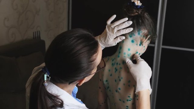Woman the doctor examines the back and neck the little girl sick with pox.