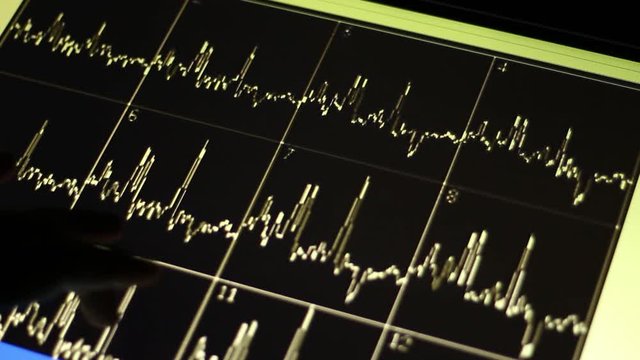 Doctor is analyzing spectra and resonance of the brain. Functional magnetic resonance spectroscopy of the brain (fMRS) uses magnetic resonance imaging (MRI) to study brain metabolism.
