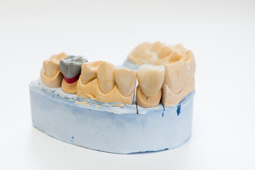 Dental gypsum model in dentist laboratory office - close-up.  Gypsum Dentures with porcelain teeth isolated on white background - copy space