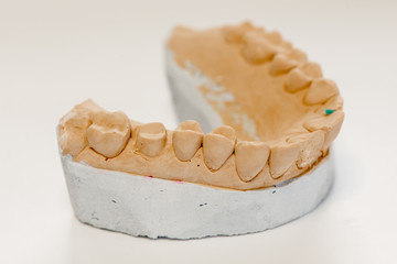 Dental gypsum model in dentist laboratory office - close-up.  Gypsum Dentures with porcelain teeth isolated on white background - copy space