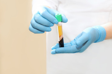 Medical test tube with blood Plasma in his hands for PRP therapy - obrazy, fototapety, plakaty