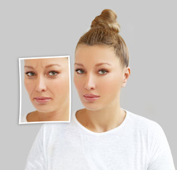 Aging. Mature woman-young woman.Face with skin problem