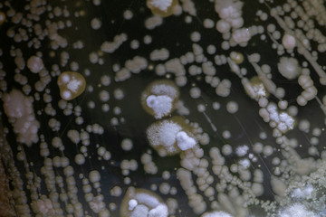 Colony characteristic of Actinomyces, Bacteria, yeast and Mold on selective media from soil samples for study in laboratory microbiology.