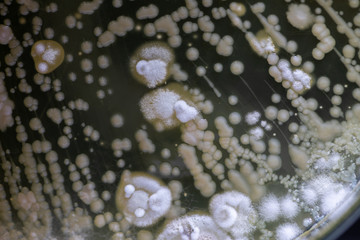 Colony characteristic of Actinomyces, Bacteria, yeast and Mold on selective media from soil samples for study in laboratory microbiology.