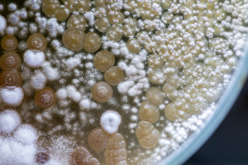 Colony characteristic of Actinomyces, Bacteria, yeast and Mold on selective media from soil samples for study in laboratory microbiology.