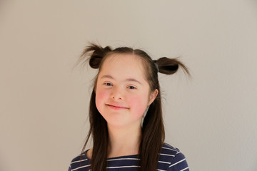 Cute smiling down syndrome girl on the grey background - 242677236