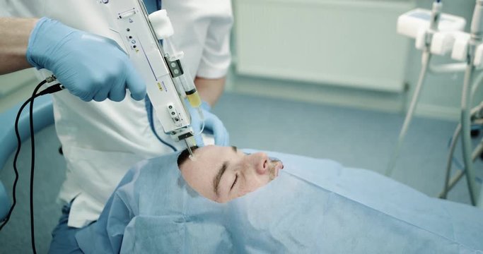 Closeup procedure of vampire facial doctor carefully working on the patient face with a prp micro-needling, patient laying down on cosmetology chair.