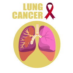 Human lungs are affected by cancer. Human health.
