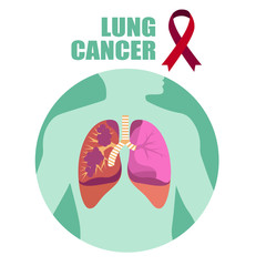 Human lungs are affected by cancer. Human health.