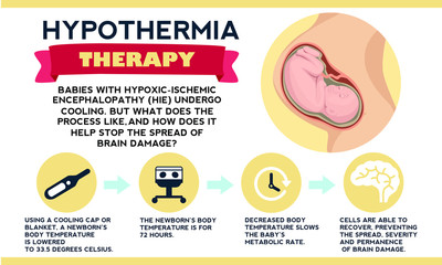 Therapeutic hypothermia. Treatment for hypoxic ischemic encephalopathy (HIE). Detailed vector Infographic. Baby Health