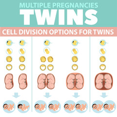 Variants of cell division under twins. Infographics. Detailed vector Infographic. Baby Health