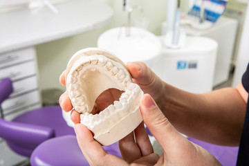 Gypsum model of jaw with teeth in in the hands of a dentist