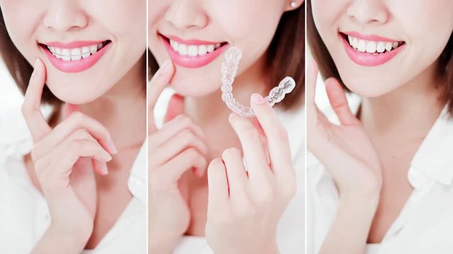 woman smile with teeth brace