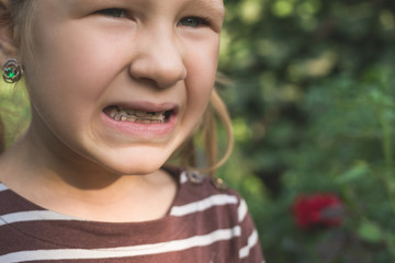 Child with a dental orthodontic device and without one tooth