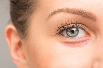 Fototapeta na wymiar Dry skin on eyelid, macro image