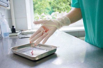 doctor in medical gloves stained with blood on medical table