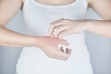 Woman scratching hand from itching on white background. Cause of itchy skin include insect bites, dermatitis, food/drugs allergies or dry skin. Concept of health care skin.
