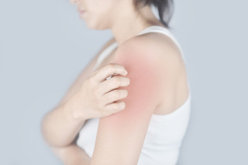 Woman scratching arm from itching on white background. Cause of itchy skin include insect bites,...