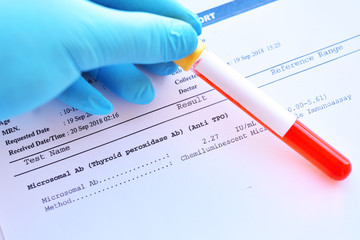 Obraz premium Laboratory result of microsomal antibody or anti-TPO test, autoimmune diagnosis