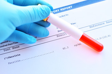 Laboratory result of ferritin test with blood sample
