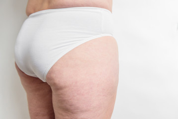 Fat female body with cellulite, overweight hips and legs on white background. Woman with cellulite problem.