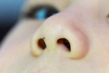 teenager's nose close up