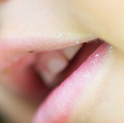 Six-year-old boy smiles, showing calf's teeth, mouth macro close-up