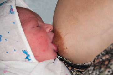 Newborn baby eats mom's milk for the first time. Newborn acne (concept of natural feeding)