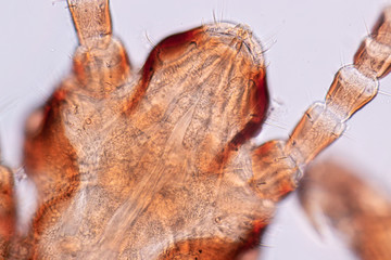 The head louse (Pediculus humanus capitis) is a parasite Live on the body, person or animal and...