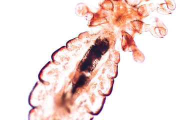 The head louse (Pediculus humanus capitis) is a parasite Live on the body, person or animal and live by sucking blood into food.