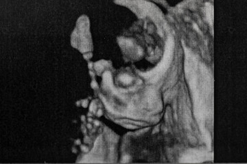 Fototapeta na wymiar Ultrasound of baby in pregnant woman.
