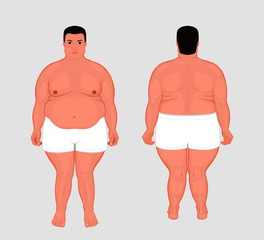 Vector illustration. Front, back views of naked European man in full growth in underwear. For advertising of cosmetic plastic procedures, stomach shunting, bypass, diet, medical publications