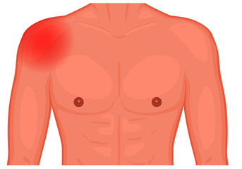 Vector illustration of a human shoulder joint with a pain or injury. Front view. For advertising, medical publications