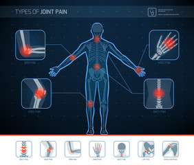 Types of joint pain infographic
