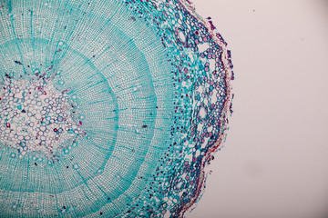 Cross-section Dicot, Monocot and Root of Plant Stem under the microscope for classroom education.  - obrazy, fototapety, plakaty