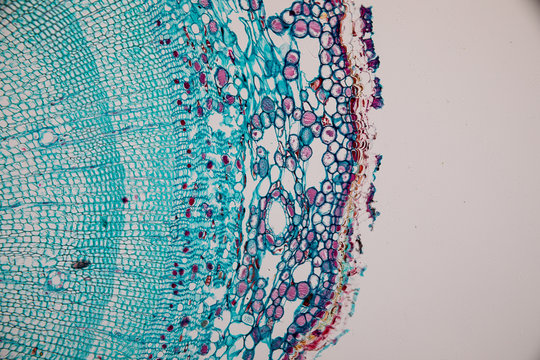 Cross-section Dicot, Monocot and Root of Plant Stem under the microscope for classroom education. 