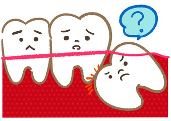 歯＿親知らず