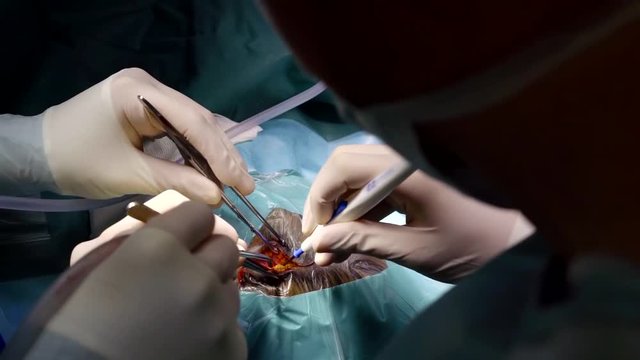 surgeons are cutting scalp on human head, preparing to trepanation of skull, close-up view
