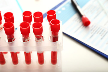Test tubes with blood samples on table in laboratory, closeup