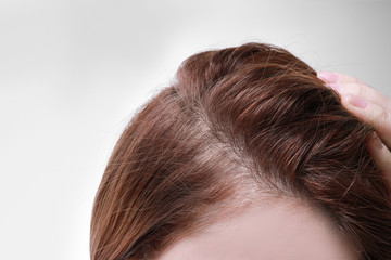 Woman with hair loss problem on white background, closeup